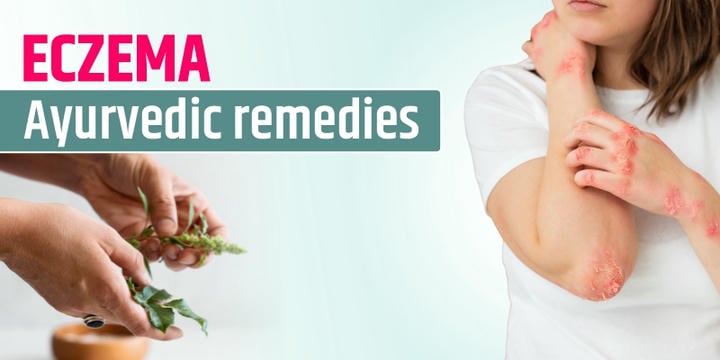 eczema-ayurveda-remedies